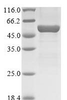Mouse Acid sphingomyelinase-like phosphodiesterase 3b (Smpdl3b) Recombinant Protein - BioCrest Sci