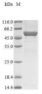 Mouse Acid sphingomyelinase-like phosphodiesterase 3b (Smpdl3b) Recombinant Protein, Mus musculus (Mouse), E.coli, N-terminal 10xHis-tagged and C-terminal Myc-tagged, 57.1 kDa, purity >≥ 85% as determined by SDS-PAGE.