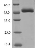 Aspergillus kawachii Probable endo-beta-1,4-glucanase D (eglD) Recombinant Protein, N-10His - BioCrest Sci