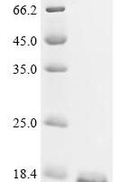 Shigella flexneri Phosphatidylglycerophosphatase B (pgpB), partial Recombinant Protein - BioCrest Sci