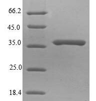 Rabies virus Matrix protein (M) Recombinant Protein, N-His-B2M - BioCrest Sci