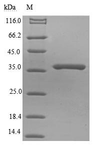Rabies virus Matrix protein (M) Recombinant Protein, N-His-B2M, Rabies virus (strain PM1503/AVO1) (RABV), E.coli, N-terminal 6xHis-B2M-tagged, 37.2 kDa, purity >≥ 85% as determined by SDS-PAGE.