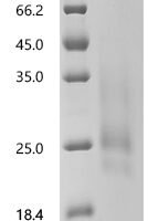 Human Seizure protein 6 homolog (SEZ6), partial Recombinant Protein, C-10His, aa 415–527, Yeast - BioCrest Sci