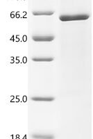 Human Roundabout homolog 3 (ROBO3), partial Recombinant Protein, C-His, aa 64–531 - BioCrest Sci