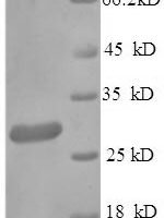 Human IgG receptor FcRn large subunit p51 (FCGRT), partial Recombinant Protein, N-His, aa 24–297, Yeast - BioCrest Sci