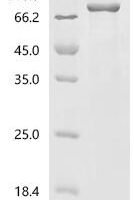 Human LIM domain-containing protein 1 (LIMD1) Recombinant Protein, N-His - BioCrest Sci