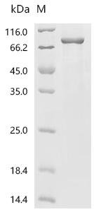 Human LIM domain-containing protein 1 (LIMD1) Recombinant Protein, N-His, Homo sapiens (Human), E.coli, N-terminal 6xHis-tagged, 78.2 kDa, purity >≥ 85% as determined by SDS-PAGE.
