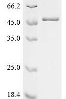 Human Tripartite motif-containing protein 51 (TRIM51) Recombinant Protein - BioCrest Sci