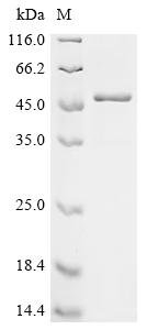 Human Tripartite motif-containing protein 51 (TRIM51) Recombinant Protein, Homo sapiens (Human), E.coli, C-terminal 6xHis-tagged, 53.4 kDa, purity >≥ 90% as determined by SDS-PAGE.