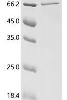 Human DEP domain-containing protein 1B (DEPDC1B) Recombinant Protein - BioCrest Sci