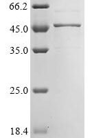 Human Hypoxia-inducible factor 1-alpha inhibitor (HIF1AN) Recombinant Protein, N-10His/C-Myc - BioCrest Sci