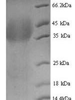 Human Lutropin-choriogonadotropic hormone receptor (LHCGR), partial Recombinant Protein, N-His, aa 27–363, Yeast - BioCrest Sci