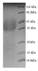 Human Lutropin-choriogonadotropic hormone receptor (LHCGR), partial Recombinant Protein, N-His, aa 27–363, Yeast, Homo sapiens (Human), Yeast, N-terminal 6xHis-tagged, 39.6 kDa, purity >≥ 90% as determined by SDS-PAGE.