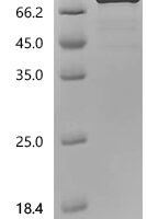 Mouse Bone morphogenetic protein 2 (Bmp2) Recombinant Protein, N-HSA/C-10His - BioCrest Sci