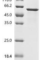 Human Cellular tumor antigen p53 (TP53) Recombinant Protein, N-His, aa 1–393, E.coli - BioCrest Sci