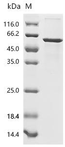 Human Cellular tumor antigen p53 (TP53) Recombinant Protein, N-His, aa 1–393, E.coli, Homo sapiens (Human), E.coli, N-terminal 6xHis-tagged, 50.6 kDa, purity >≥ 90% as determined by SDS-PAGE.