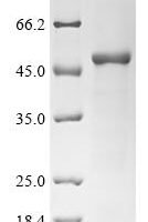 Measles virus Fusion glycoprotein F0 (F), partial Recombinant Protein, N-His - BioCrest Sci