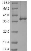 Human E3 ubiquitin-protein ligase RBX1 (RBX1) Recombinant Protein - BioCrest Sci
