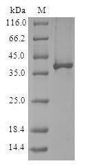 Human E3 ubiquitin-protein ligase RBX1 (RBX1) Recombinant Protein, Homo sapiens (Human), E.coli, N-terminal GST-tagged, 39.3 kDa, purity >≥ 90% as determined by SDS-PAGE.