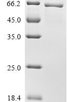 Human Ryanodine receptor 1 (RYR1), partial Recombinant Protein, N-10His - BioCrest Sci