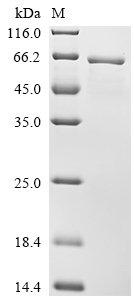 Human Ryanodine receptor 1 (RYR1), partial Recombinant Protein, N-10His, Homo sapiens (Human), E.coli, N-terminal 10xHis-tagged, 65.4 kDa, purity >≥ 85% as determined by SDS-PAGE.