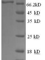 Cat Macrophage colony-stimulating factor 1 receptor (CSF1R), partial Recombinant Protein - BioCrest Sci