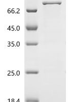 Human Clathrin interactor 1 (CLINT1) Recombinant Protein, C-His - BioCrest Sci