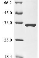 Escherichia coli O157:H7 3-deoxy-manno-octulosonate cytidylyltransferase (kdsB) Recombinant Protein - BioCrest Sci