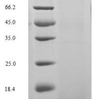 Hirudo medicinalis Hirudin variant-1 Recombinant Protein - BioCrest Sci