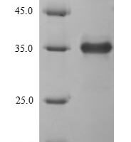 Enterobacteria phage T4 Endolysin (E) Recombinant Protein, N-His-SUMO - BioCrest Sci