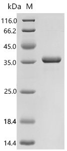 Human Phosphoserine phosphatase(PSPH) Recombinant Protein, Homo sapiens (Human), E.coli, C-terminal 6xHis-tagged, 31.9 kDa, purity >≥ 95% as determined by SDS-PAGE.