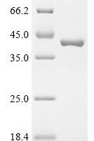 Shigella flexneri Virulence sensor protein PhoQ (phoQ), partial Recombinant Protein - BioCrest Sci