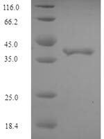 Escherichia coli Elongation factor P (efp) Recombinant Protein, N-His-SUMO - BioCrest Sci