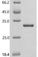 Human ADP-ribosylation factor-like protein 4A (ARL4A) Recombinant Protein, C-His - BioCrest Sci