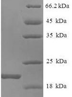 Mouse Allograft inflammatory factor 1 (Aif1) Recombinant Protein - BioCrest Sci