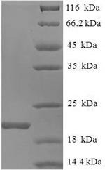 Mouse Allograft inflammatory factor 1 (Aif1) Recombinant Protein, Mus musculus (Mouse), E.coli, N-terminal 6xHis-tagged, 20.8 kDa, purity >≥ 90% as determined by SDS-PAGE.