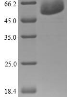 Human Tryptophan--tRNA ligase, cytoplasmic (WARS) Recombinant Protein - BioCrest Sci