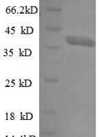 Human E3 ubiquitin-protein ligase TRIM11 (TRIM11), partial Recombinant Protein - BioCrest Sci