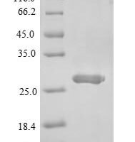 Mouse Single Ig IL-1-related receptor (Sigirr), partial Recombinant Protein - BioCrest Sci