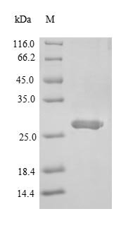 Mouse Single Ig IL-1-related receptor (Sigirr), partial Recombinant Protein, Mus musculus (Mouse), E.coli, N-terminal 6xHis-SUMO-tagged, 28.7 kDa, purity >≥ 90% as determined by SDS-PAGE.