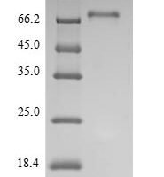 Human Tyrosine-protein kinase Lck (LCK) Recombinant Protein - BioCrest Sci