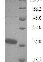 Bordetella pertussis Pertussis toxin subunit 1 (ptxA) Recombinant Protein, N-His, aa 35–269, Yeast - BioCrest Sci