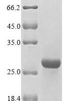 Human HLA class II histocompatibility antigen, DM beta chain (HLA-DMB), partial Recombinant Protein - BioCrest Sci
