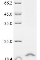 Human Thiamine transporter 1 (SLC19A2), partial Recombinant Protein - BioCrest Sci