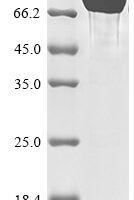 Human Tyrosine-protein phosphatase non-receptor type substrate 1 (SIRPA), partial Recombinant Protein, C-hFc1-Myc - BioCrest Sci
