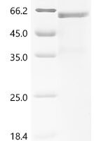 Human Islet cell autoantigen 1 (ICA1) Recombinant Protein, C-10His - BioCrest Sci