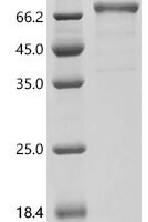 Human Leucine-rich repeat-containing G-protein coupled receptor 5 (LGR5) , partial Recombinant Protein - BioCrest Sci