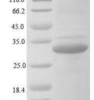 Human Ficolin-3 (FCN3) Recombinant Protein - BioCrest Sci