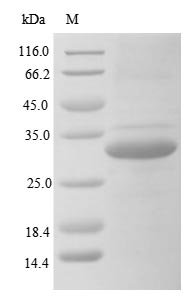 Human Ficolin-3 (FCN3) Recombinant Protein, Homo sapiens (Human), E.coli, N-terminal 6xHis-tagged, 34.4 kDa, purity >≥ 85% as determined by SDS-PAGE.