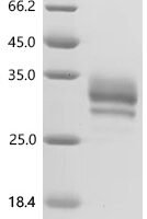 Human Folate receptor beta (FOLR2), partial Recombinant Protein - BioCrest Sci